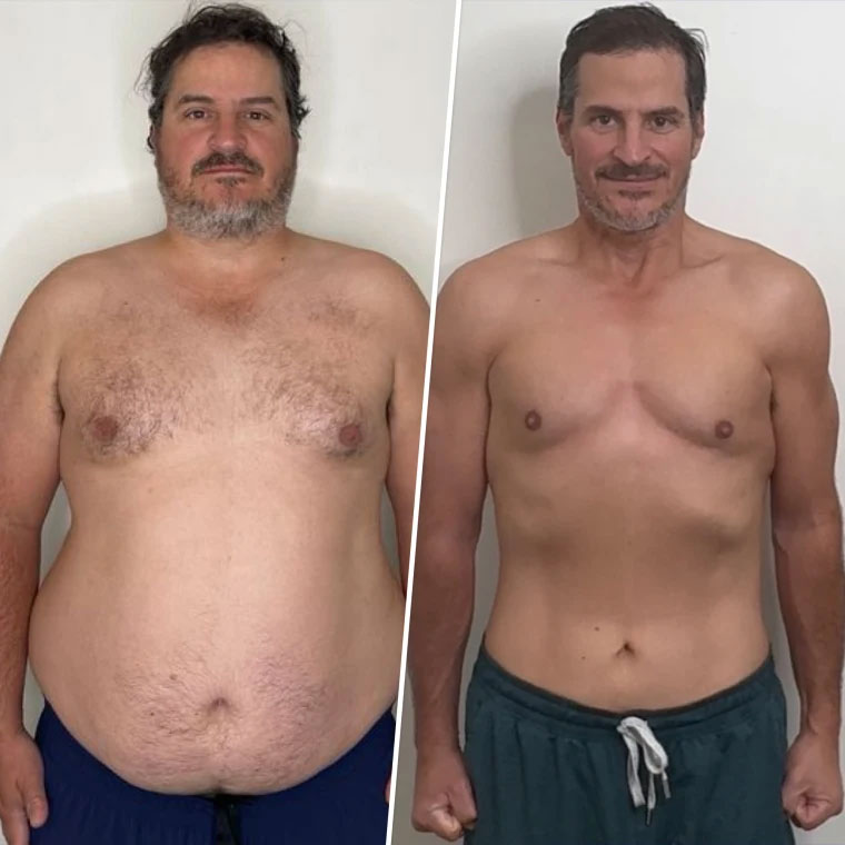 Before and after photo of a patient's weight loss results